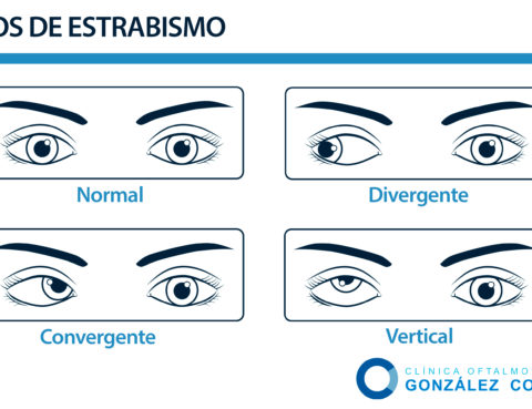 tipos de estrabismo