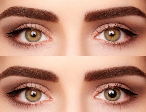 anisocoria