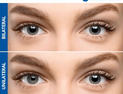 midriasis