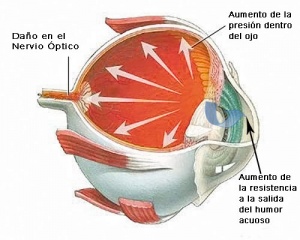 dia mundial glaucoma